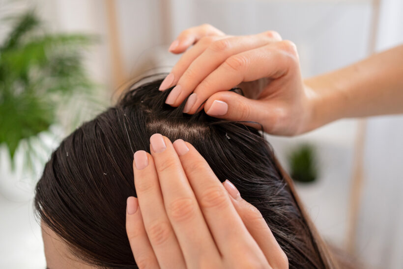 بررسی جامع شوره سر و راهکارهای درمانی نوین