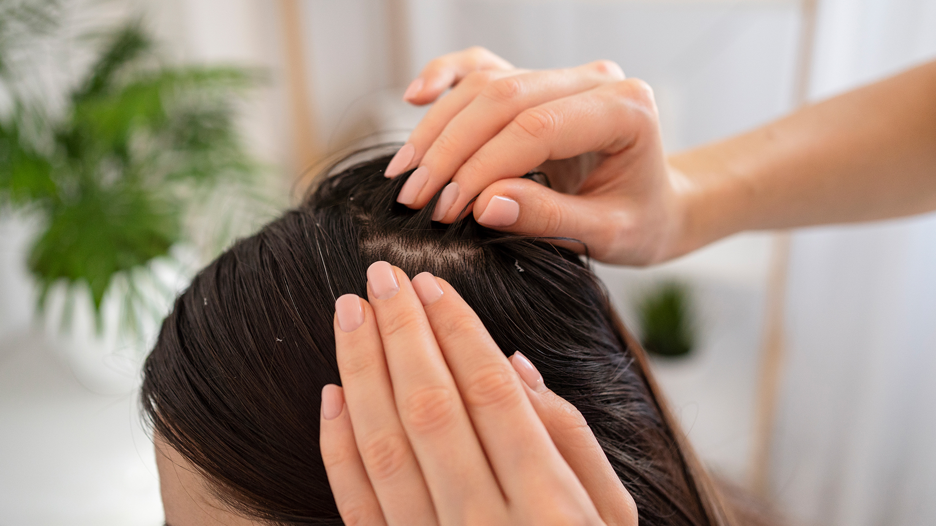 بررسی جامع شوره سر و راهکارهای درمانی نوین